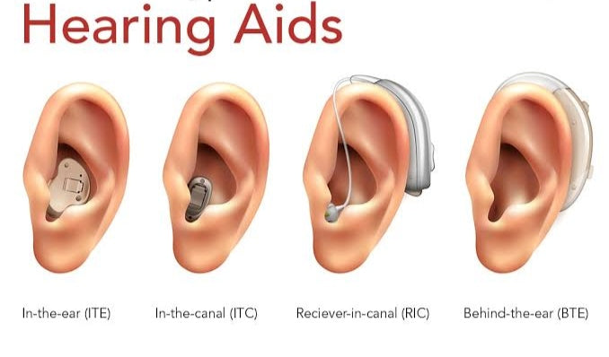 Hearing Aid