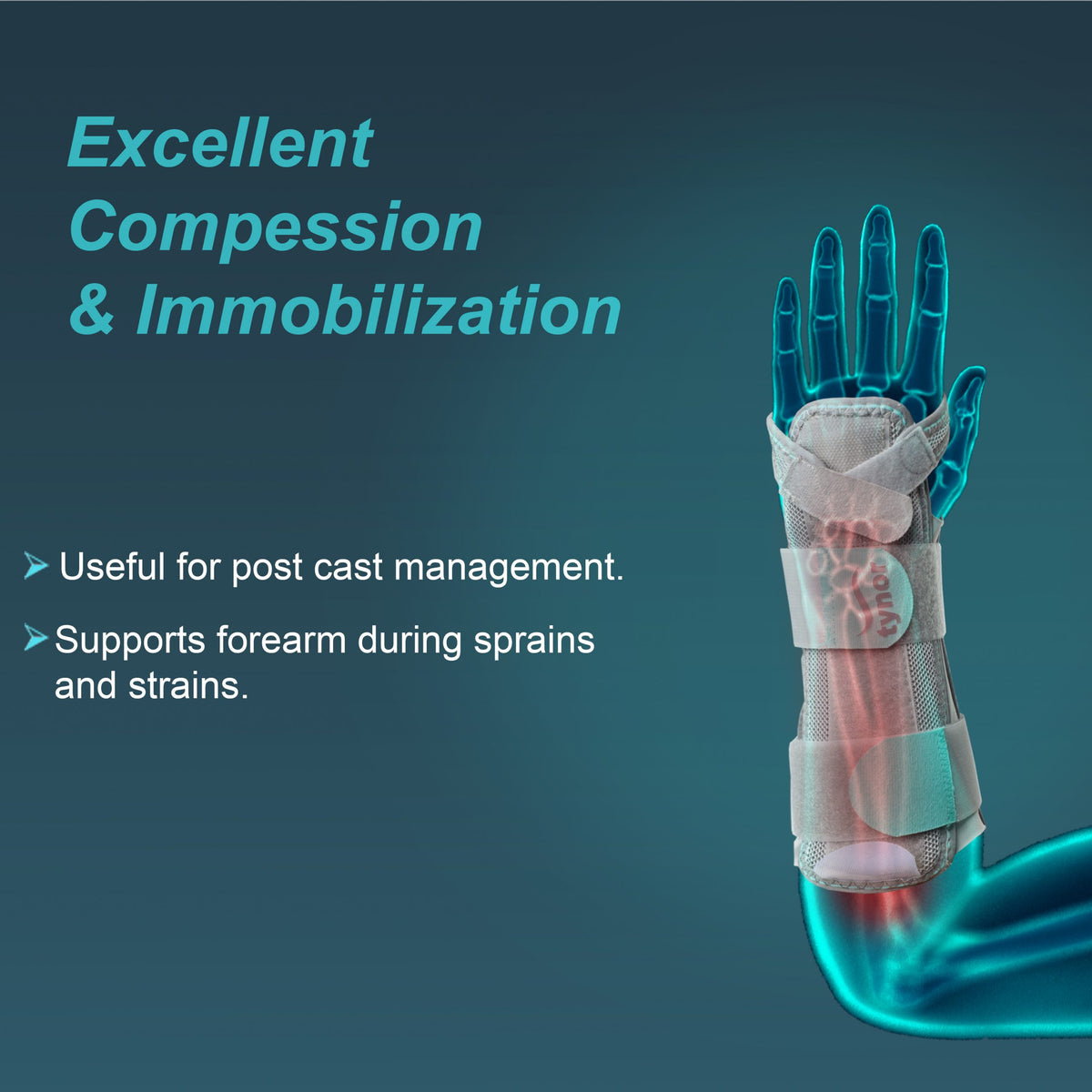 Forearm Rotation Splinting Forearm Splint, Grey, 1 Unit – MedineedsIndia